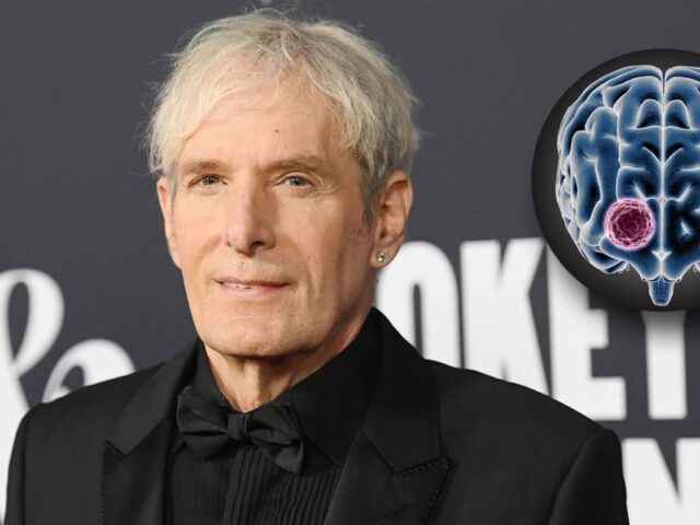 Ο Michael Bolton επιτυχής στην χειρουργική επέμβαση