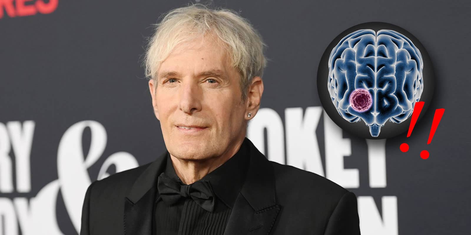 Ο Michael Bolton επιτυχής στην χειρουργική επέμβαση